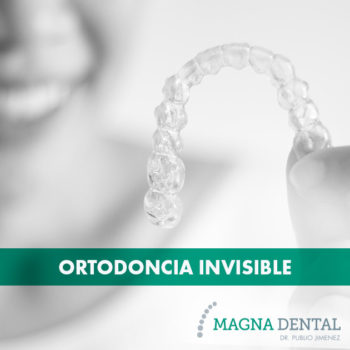 Ortodoncia Invisible - Magna Dental