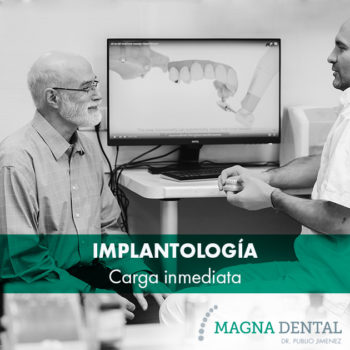Implantología - Carga Inmediata- Magna Dental